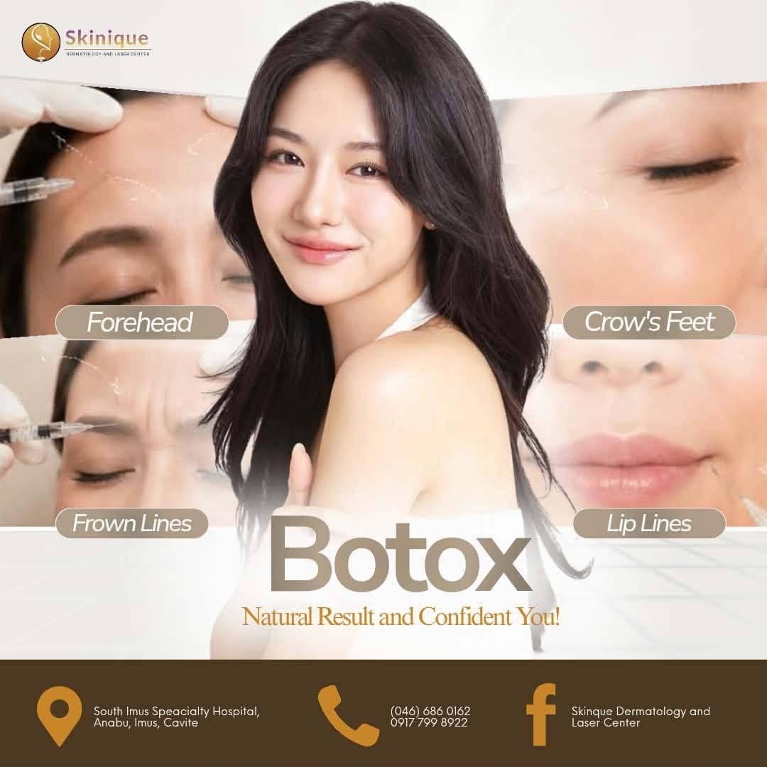 Botox poster showing the treated areas: forehead, frown lines, crow’s feet and lip lines