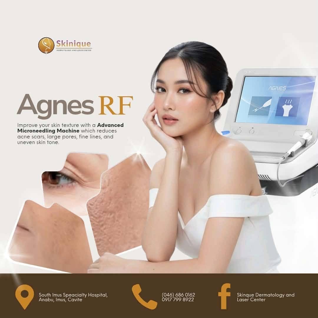 Agnes RF poster: an advanced microneedling machine that reduces acne scars, large pores, fine lines and uneven skin tone